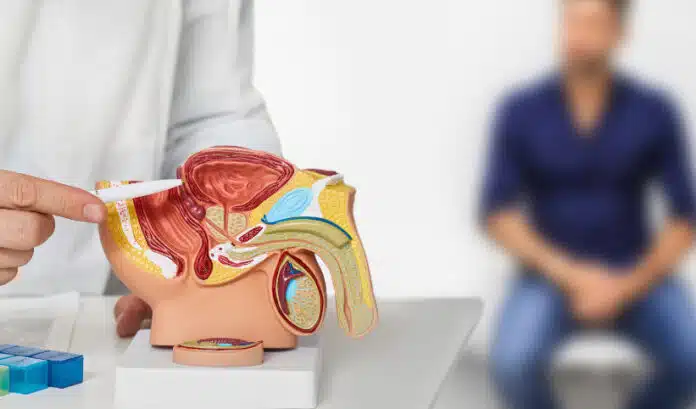 Facteurs de risque et symptomes du cancer de la prostate